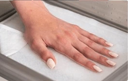 Hidroxa iontophoresis machine setup guide connecting the electrodes for hyperhidrosis treatment